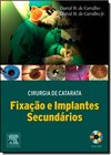Cirurgia De Catarata Fixacao E Implantes Secundarios 1/E