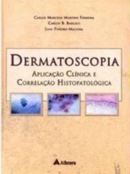 Dermatoscopia:  Aplicação Clínica e Correlação Histopatológica