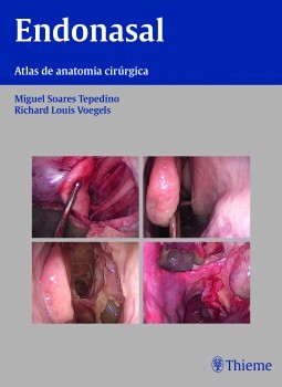 Endonasal: atlas de anatomia cirúrgica