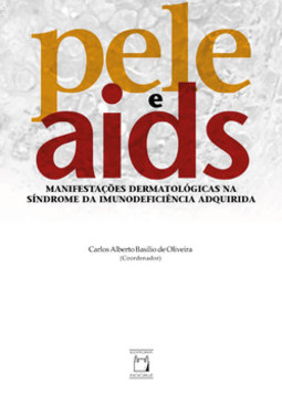 Pele e Aids: manifestações dermatológicas na síndrome da imunodeficiência adquirida