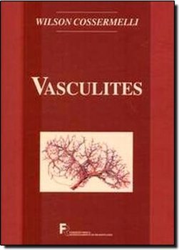Vasculites