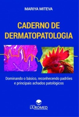 Caderno de dermatopatologia: dominando o básico, reconhecendo padrões e principais achados patológicos