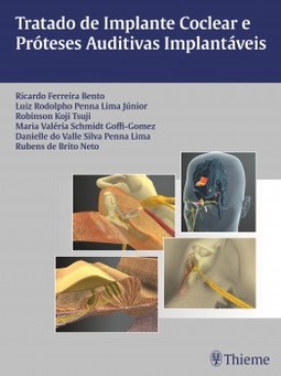 Tratado de implante coclear e próteses auditivas implantáveis