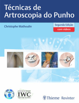 Técnicas de artroscopia do punho