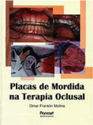 Placas de Mordida na Terapia Oclusal