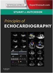 Principles of Echocardiography and Intracardiac Echocardiography