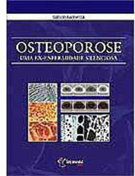 Osteoporose: uma Ex-Enfermidade Silenciosa