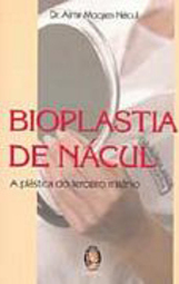 Bioplastia de Nácul: a Plástica do Terceiro Milênio