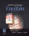 Diagnóstico por imagem - Encéfalo