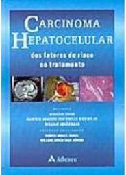 Carcinoma hepatocelular: dos fatores de risco ao tratamento