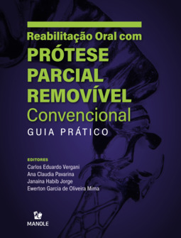 Reabilitação oral com prótese parcial removível convencional: guia prático