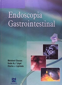 Endoscopia Gastrointestinal