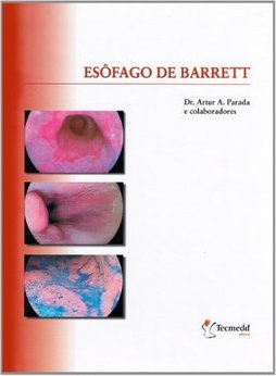 Esôfago de Barrett