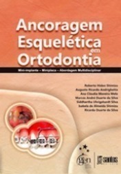 Ancoragem Esquelética em Ortodontia