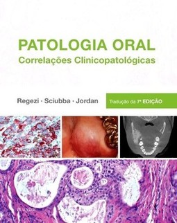 Patologia oral
