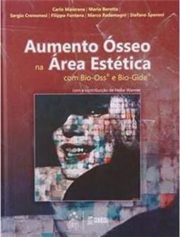 Aumento Ósseo na Área Estética