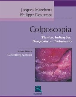 Colposcopia: Técnica, Indicações, Diagnóstico e Tratamento
