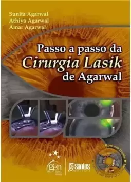 Passo A Passo Da Cirurgia Lasik