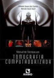 MANUAL DE TECNICAS EM TOMOGRAFIA COMPUTADORIZADA