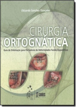 Cirurgia Ortognatica Guia De Orientacao Para Portadores De Deformidades Faciais Esqueleticas