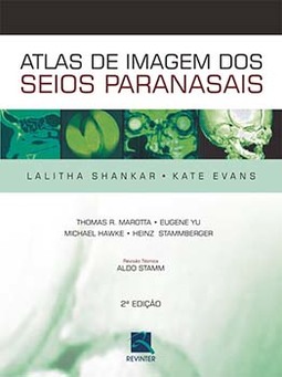 Atlas de imagem dos seios paranasais