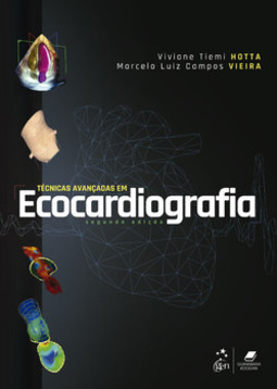 Técnicas avançadas em ecocardiografia