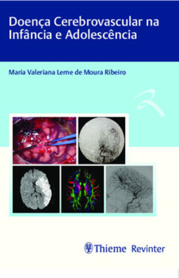 Doença cerebrovascular na infância e adolescência