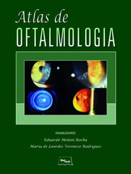 Atlas de oftalmologia