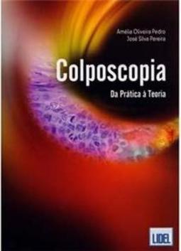 Colposcopia