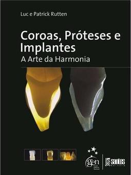 Coroas, Próteses e Implantes