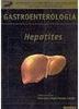 Gastroenterologia: Hepatites