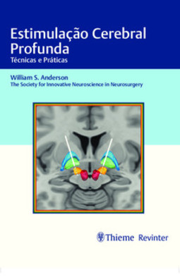 Estimulação cerebral profunda: técnicas e práticas