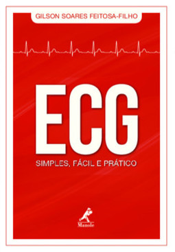 ECG simples, fácil e prático