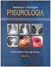Pneumologia: Atualização e Reciclagem - vol. 6