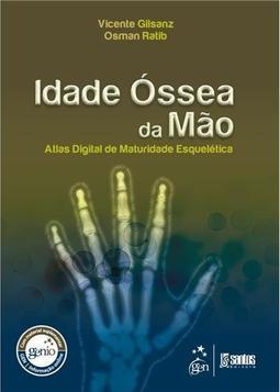 Idade Óssea da Mão