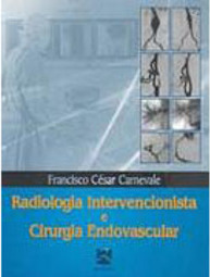 Radiologia Intervencionista e Cirurgia Endovascular
