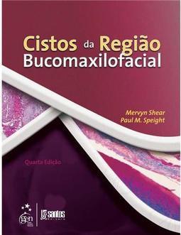 Cistos da Região Bucomaxilofacial