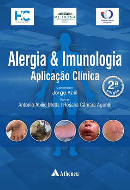 Alergia e imunologia – Aplicação clínica