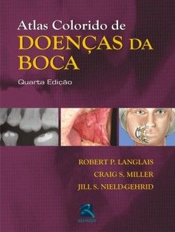 Atlas colorido de doenças da boca