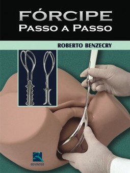 Fórcipe passo a passo