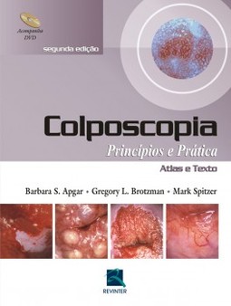 Colposcopia: princípios e prática