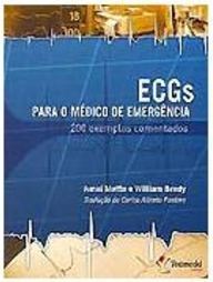 ECGs para o Médico de Emergência: 200 Casos Comentados
