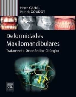 Deformidades maxilomandibulares: tratamento ortodôntico-cirúrgico