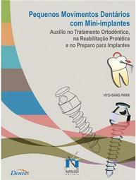 Pequenos Movimentos Dentários Com Mini-Implantes
