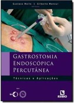 Gastrostomia endoscópica percutânea: Técnicas e aplicações