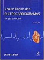 Análise Rápida dos Eletrocardiogramas