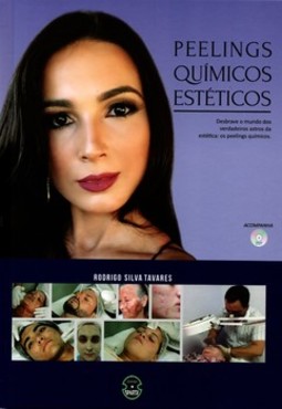 Peelings químicos estéticos