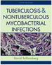Tuberculosis & Nontuberculous Mycobacterial Infections - Importado