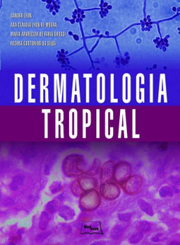 Dermatologia tropical