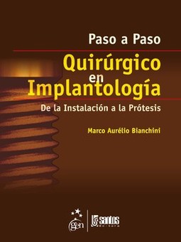 Paso a paso quirúrgico en implantología: de la instalación a la prótesis